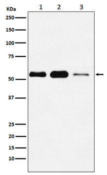 ATGL / PNPLA2 Rabbit Monoclonal Antibody