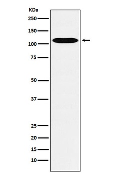 GPCR / LGR6 Rabbit Monoclonal Antibody