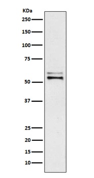 Angiotensinogen Rabbit Monoclonal Antibody