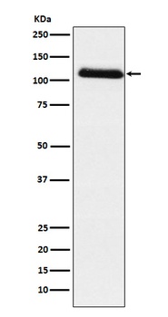 Anti-Fibrinogen alpha chain Rabbit Monoclonal Antibody