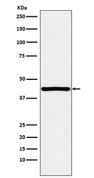 Anti-HOXA13 Rabbit Monoclonal Antibody