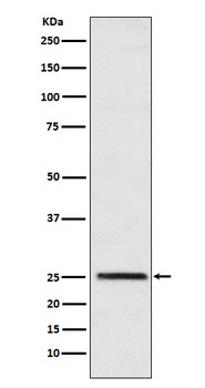 Triosephosphate isomerase Rabbit Monoclonal Antibody