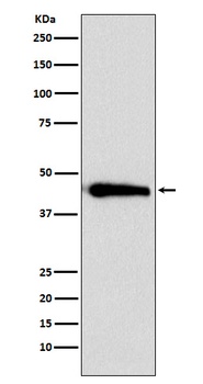 Anti-ASS1 Rabbit Monoclonal Antibody