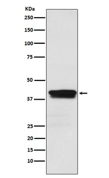 Anti-MBNL1 Rabbit Monoclonal Antibody