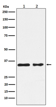 CSNK1A1 Rabbit Monoclonal Antibody