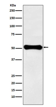 Anti-GLUD1 Rabbit Monoclonal Antibody