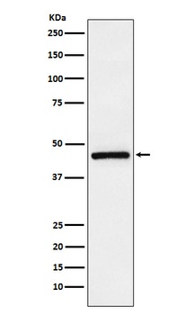 Anti-TMEFF2 Rabbit Monoclonal Antibody