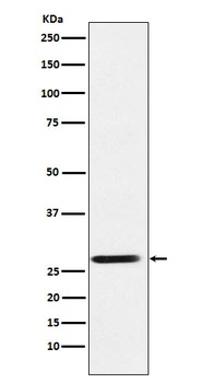 SRD5A2 Rabbit Monoclonal Antibody