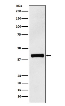 Anti-IL12 p40 Rabbit Monoclonal Antibody