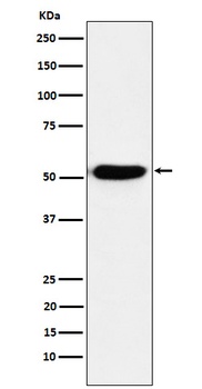Anti-IRF4 Rabbit Monoclonal Antibody