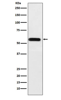 Anti-ANGPTL3 Rabbit Monoclonal Antibody