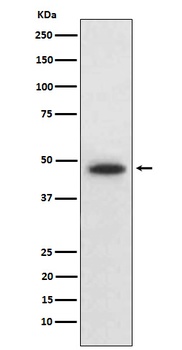 Anti-Wnt5b Rabbit Monoclonal Antibody