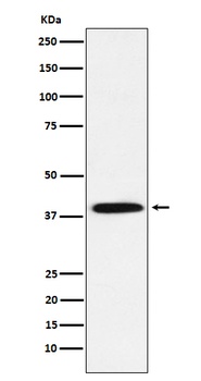 Phospho-IKB alpha (S36) Rabbit Monoclonal Antibody