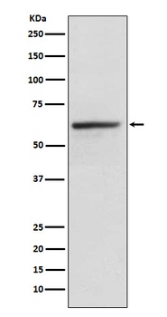 KLC1 Rabbit Monoclonal Antibody