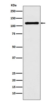 Anti-DPYD Rabbit Monoclonal Antibody