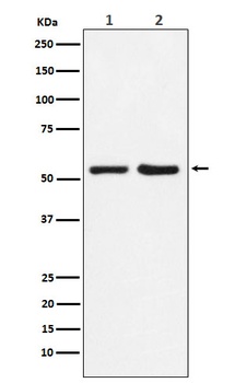 P4HB Rabbit Monoclonal Antibody
