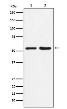 Anti-P4HB Rabbit Monoclonal Antibody