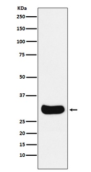Anti-Gemin 2 Rabbit Monoclonal Antibody