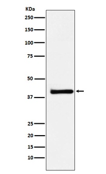 XRCC3 Rabbit Monoclonal Antibody