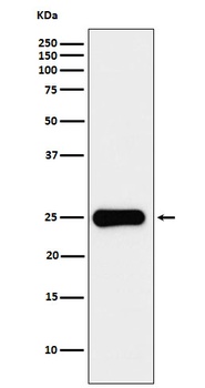 Anti-Placental lactogen Rabbit Monoclonal Antibody
