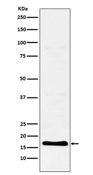 Anti-TFF2 Rabbit Monoclonal Antibody