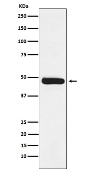Anti-ERCC8 Rabbit Monoclonal Antibody