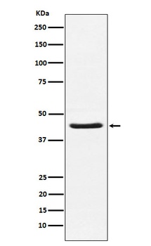 Anti-HSD3B1 Rabbit Monoclonal Antibody