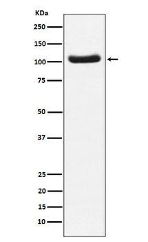 Anti-PDE2A Rabbit Monoclonal Antibody