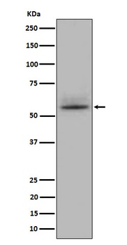 Anti-CD147 Rabbit Monoclonal Antibody