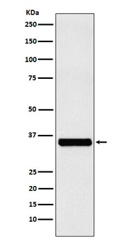 Anti-EXOSC7 Rabbit Monoclonal Antibody
