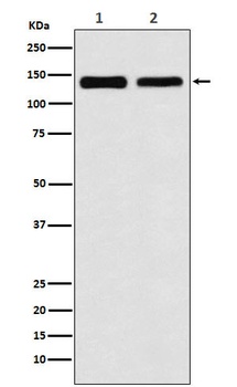 Anti-UBE4B Rabbit Monoclonal Antibody