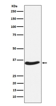 Anti-EXOSC7 Rabbit Monoclonal Antibody