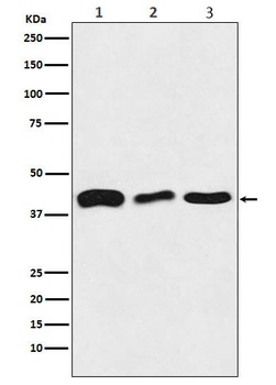 Anti-TDP43 Rabbit Monoclonal Antibody