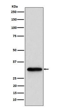 Anti-NUDT5 Rabbit Monoclonal Antibody