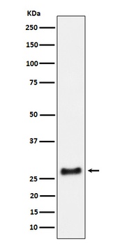 Anti-SNRPA1 Rabbit Monoclonal Antibody