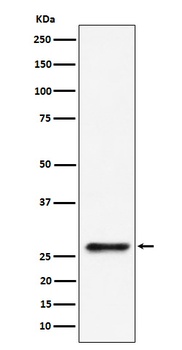 Anti-SBDS Rabbit Monoclonal Antibody