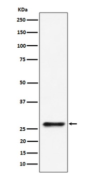 SBDS Rabbit Monoclonal Antibody