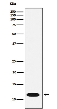 Anti-CTNNBIP1 Rabbit Monoclonal Antibody