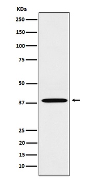 LTB4R Rabbit Monoclonal Antibody