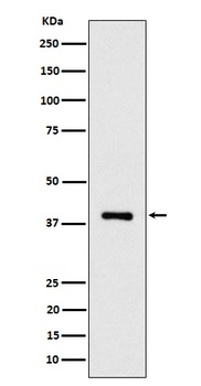 Anti-ACAT2 Rabbit Monoclonal Antibody