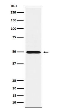 Anti-HGD Rabbit Monoclonal Antibody