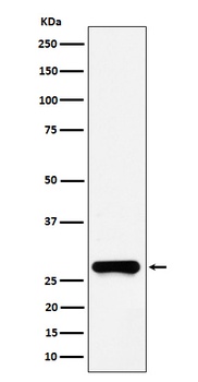 Anti-GSTO1 Rabbit Monoclonal Antibody