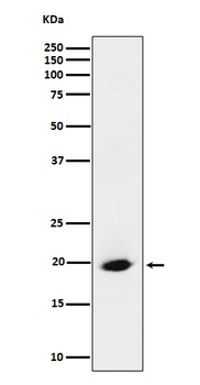 Anti-SRP19 Rabbit Monoclonal Antibody