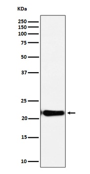 Anti-DNPH1 Rabbit Monoclonal Antibody