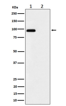 Phospho-FGFR3 (Y724) Rabbit Monoclonal Antibody