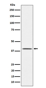 Anti-TTF1 Rabbit Monoclonal Antibody