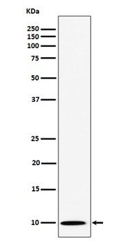Anti-NOP10 Rabbit Monoclonal Antibody