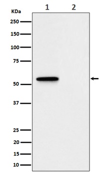 Phospho-MLKL (S345) Rabbit Monoclonal Antibody