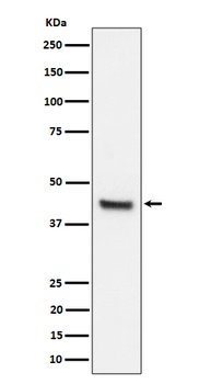 IL11RA Rabbit Monoclonal Antibody