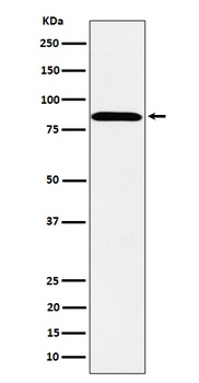 Anti-PPM1E Rabbit Monoclonal Antibody